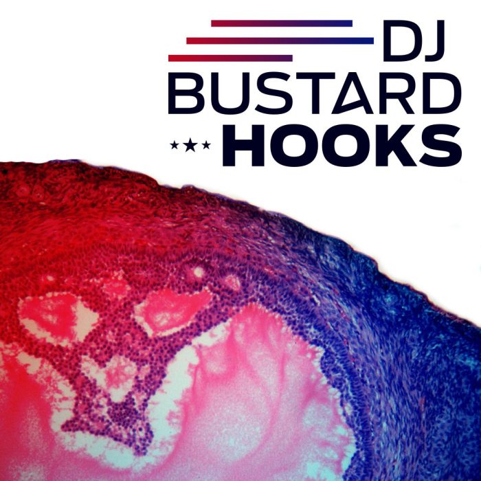 Diginoiz Dj Bustard Hooks